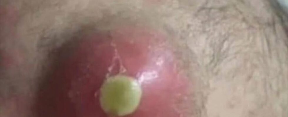 8 ALARMING SKIN SIGNS YOU CAN’T 8 ALARMING SKIN SIGNS YOU CAN’T