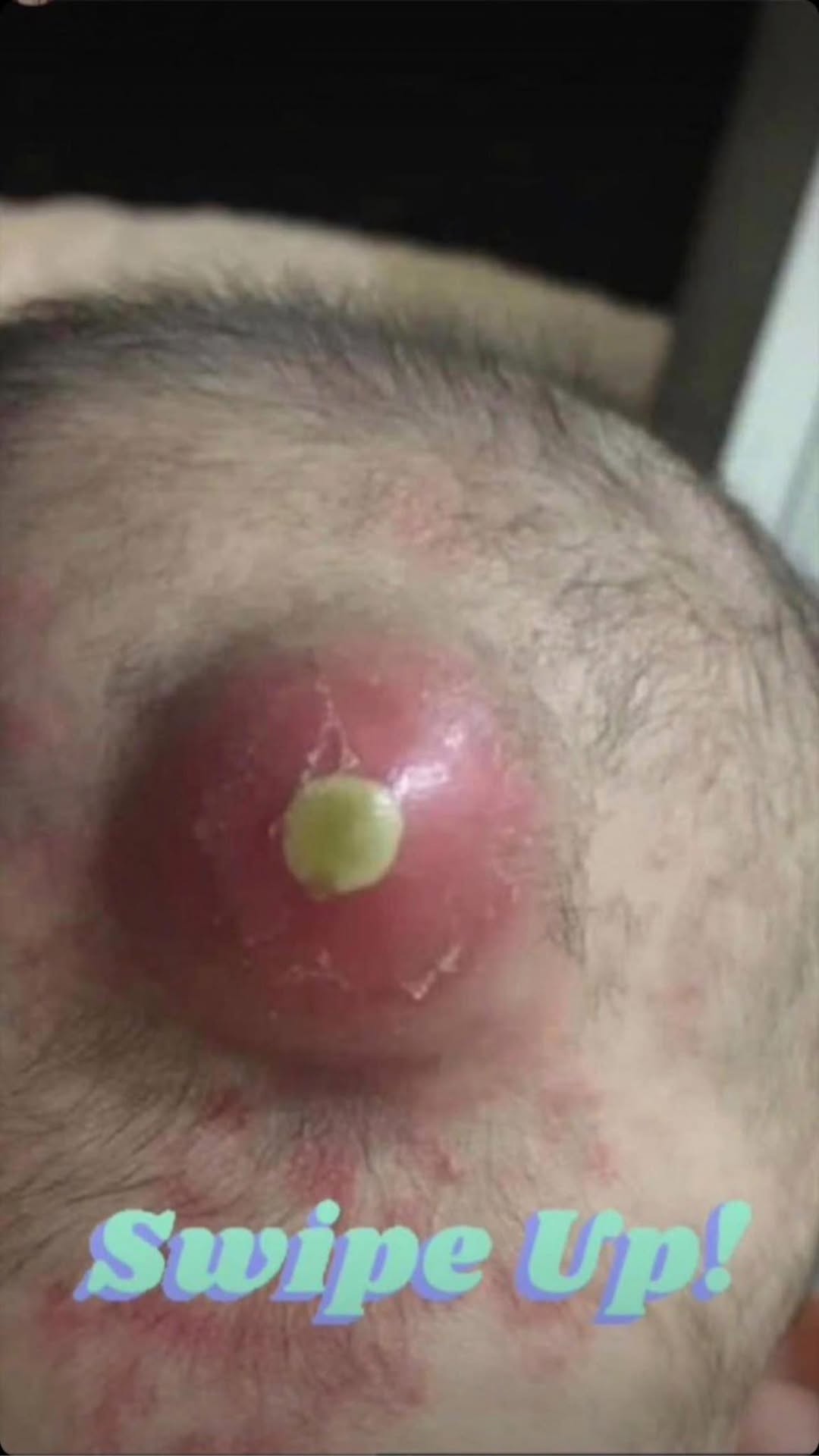 8 ALARMING SKIN SIGNS YOU CAN’T
